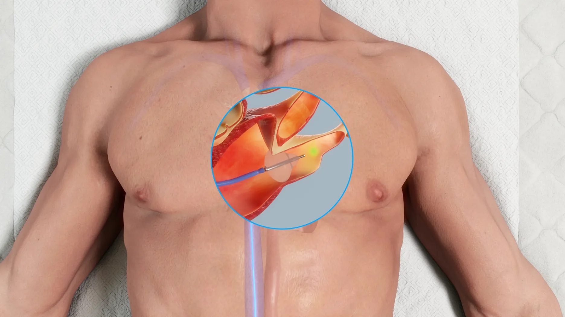 Thieme Compliance —  Cardio