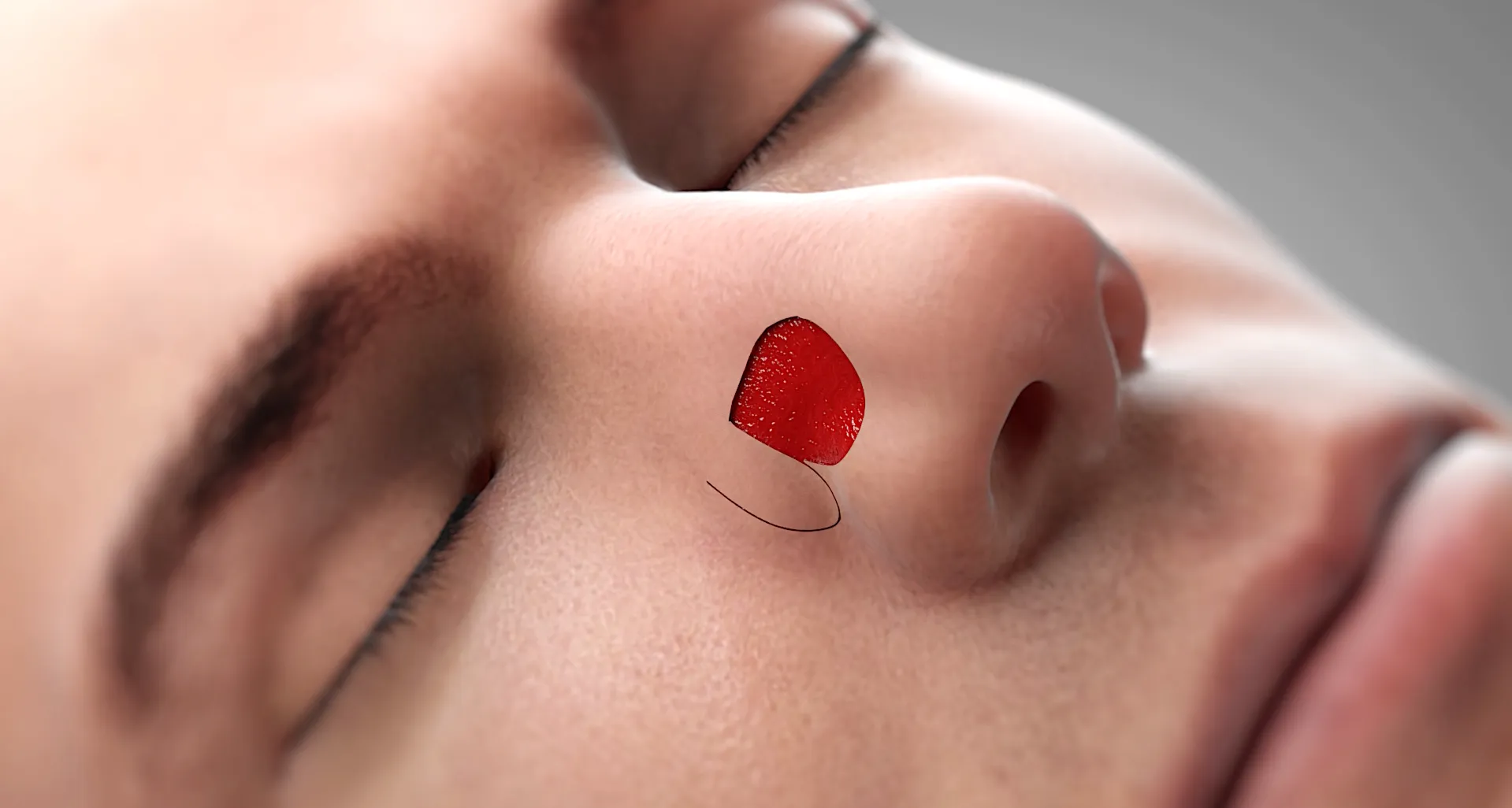 Thieme Compliance — Hauttumor im Gesicht